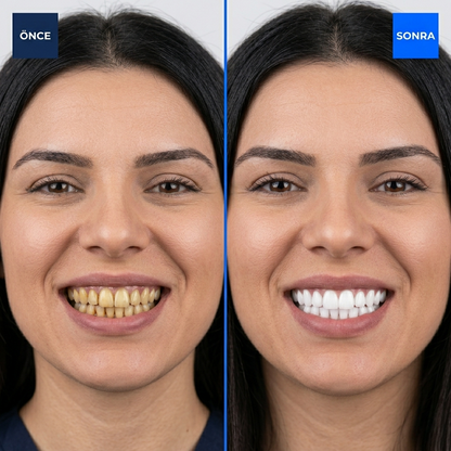 Dentimax™ Termal LED Diş Beyazlatma Seti